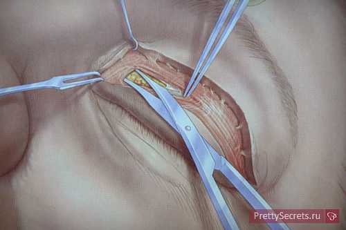 что такое партнерская программа: 8 советов по заработку