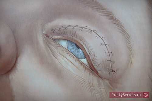 что такое велнес: концепция здорового образа жизни что такое велнес: концепция здорового образа жизни